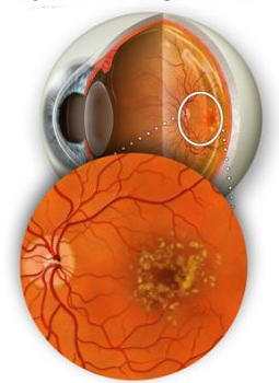 b-vitamin a látás javítása érdekében a látás felbecsülhetetlen